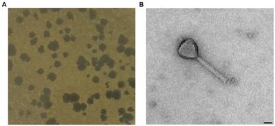 Xylella phage MATE 2: a novel bacteriophage with potent lytic activity against Xylella fastidiosa subsp. pauca